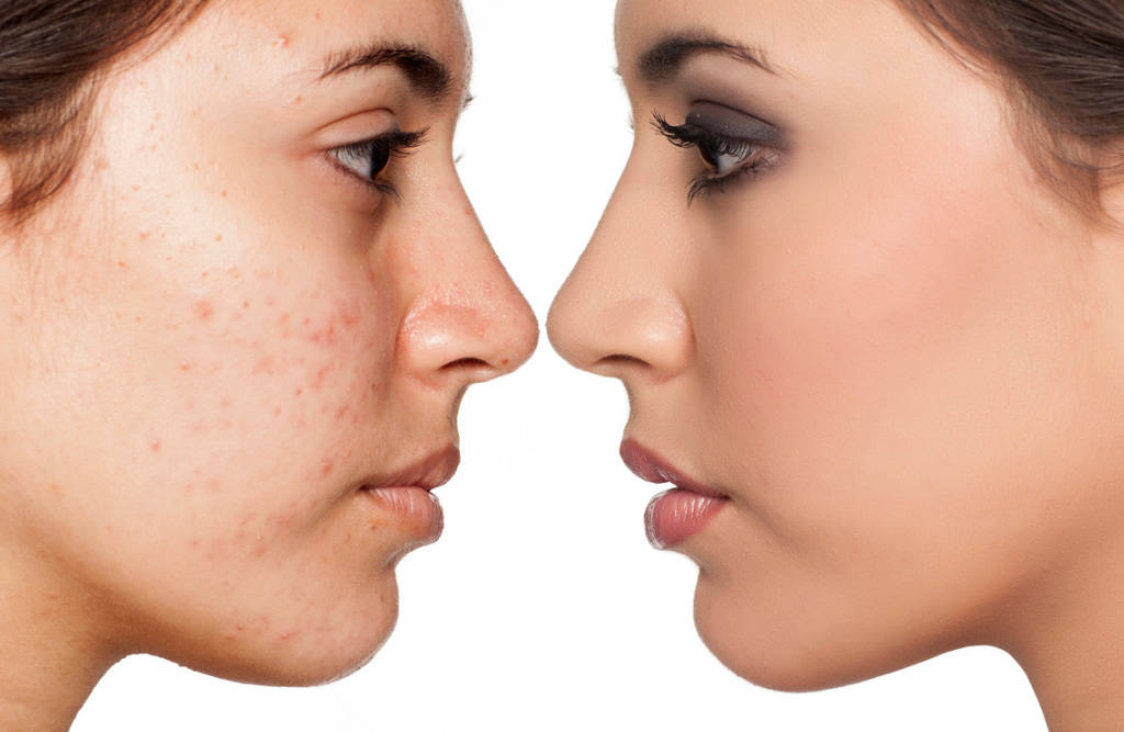 Soin Esthétique ionoderme